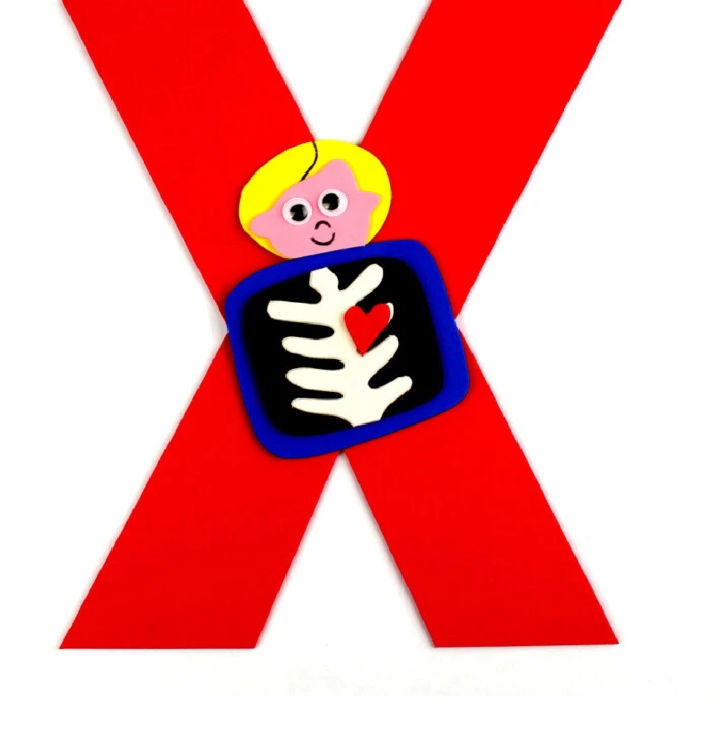 Letter X is for X Ray